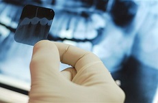 Профилактика и гигиена полости рта Профилактика и гигиена полости рта